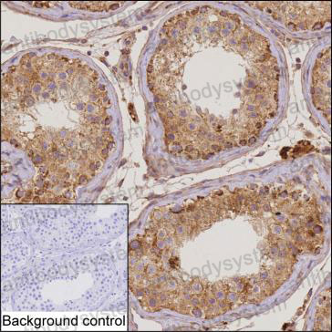 Anti-TRIML2 Antibody (R4C61)
