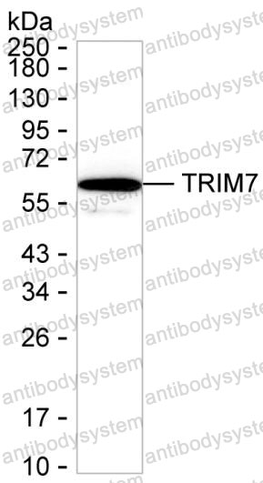Anti-TRIM7 Antibody (R4C64)