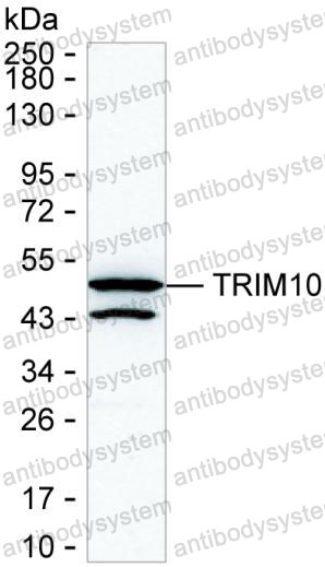 Anti-TRIM10 Antibody (R4C65)