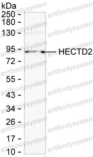 Anti-HECTD2 Antibody (R4C67)