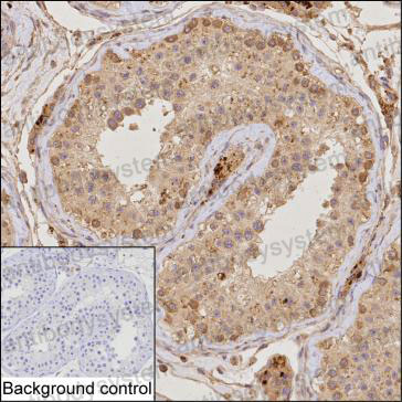 Anti-TRIM17 Antibody (R4C68)