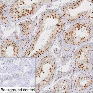 Anti-UBR7 Antibody (R4C69)