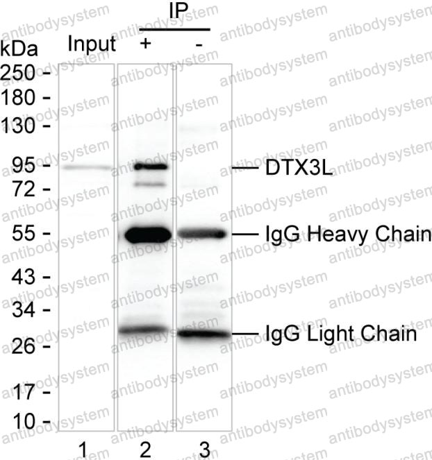 Anti-DTX3L Antibody (R4C70)