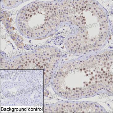Anti-NSMCE1 Antibody (R4C71)