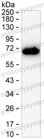 Anti-PDLIM5 Antibody (R4C72)