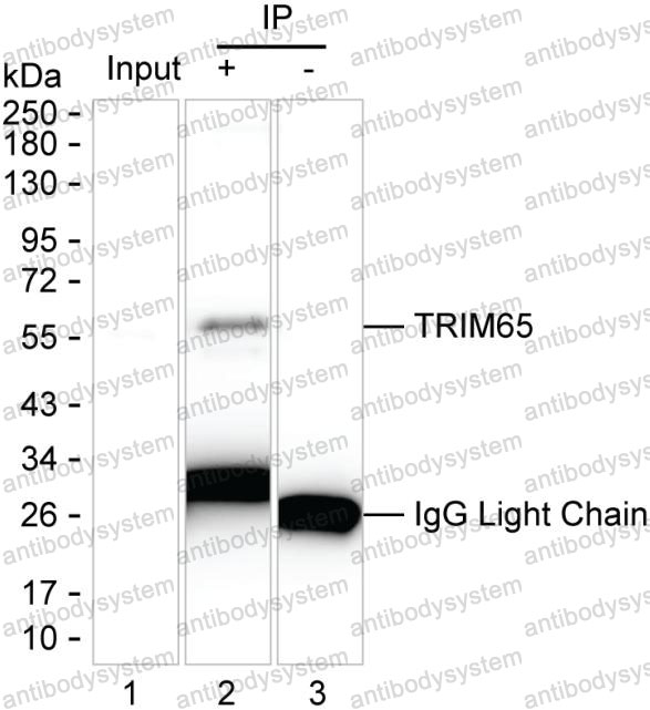 Anti-TRIM65 Antibody (R4C75)