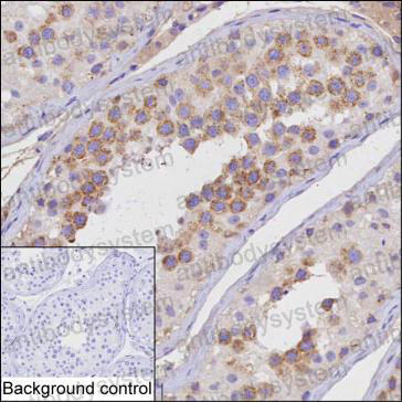 Anti-CBLL2 Antibody (R4C77)