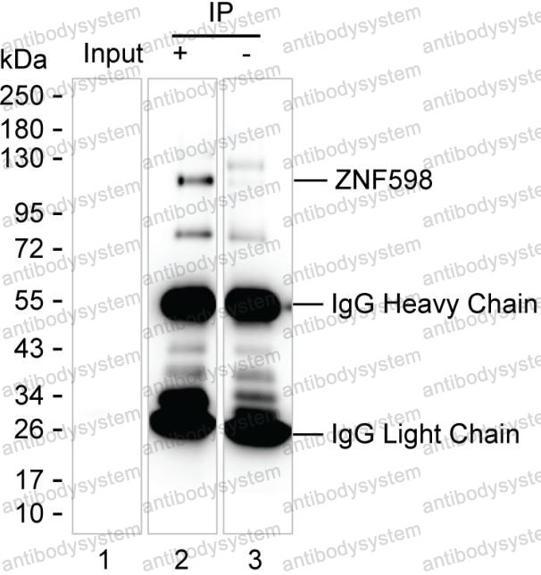 Anti-ZNF598 Antibody (R4C78)