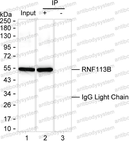Anti-RNF113B Antibody (R4C80)