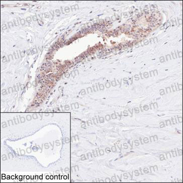 Anti-RNF113B Antibody (R4C79)