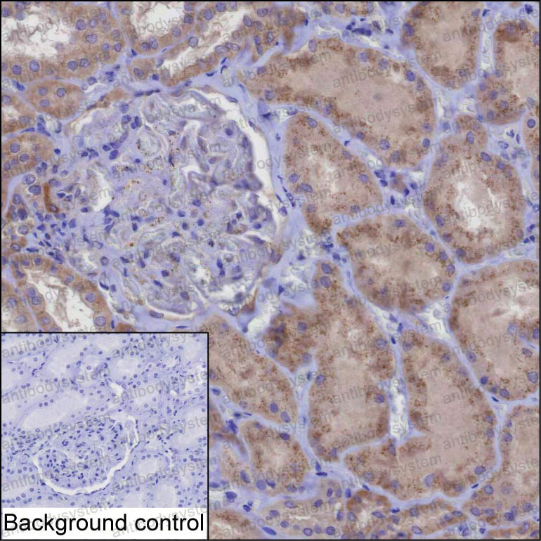 Anti-KIFBP Antibody (R4C83)