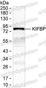 Anti-KIFBP Antibody (R4C81)