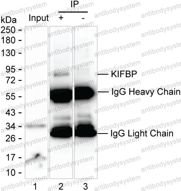 Anti-KIFBP Antibody (R4C82)