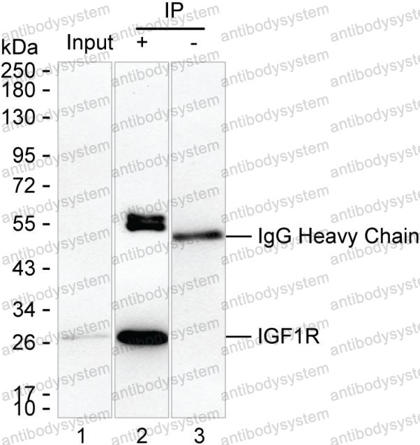Anti-DPCD Antibody (R4C84)