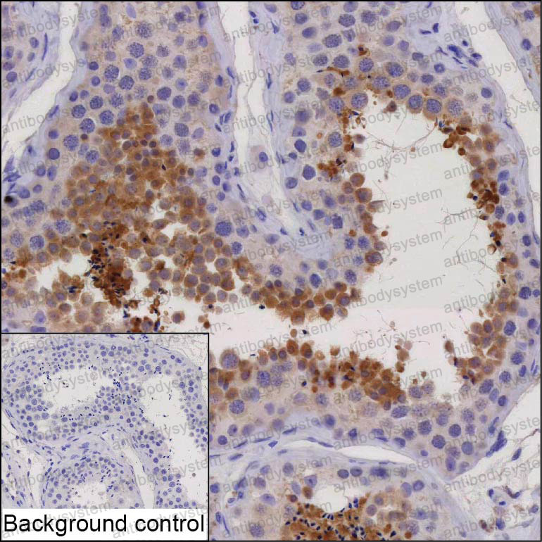 Anti-DPCD Antibody (R4C85)