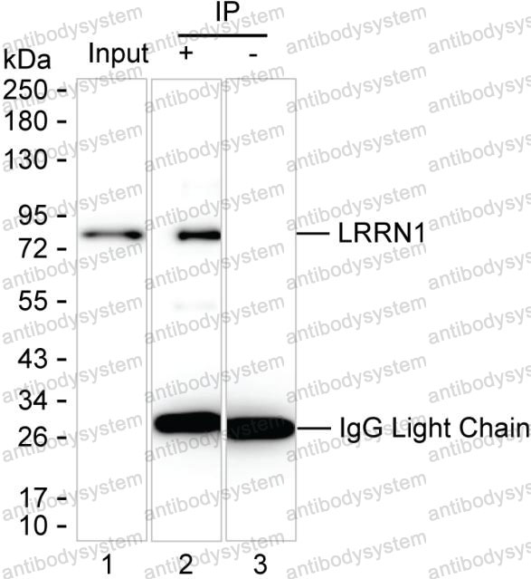 Anti-LRRN1 Antibody (R4C86)