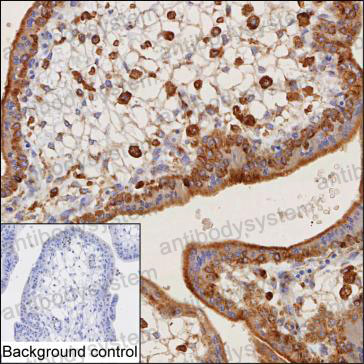 Anti-COLEC12 Antibody (R4C89)