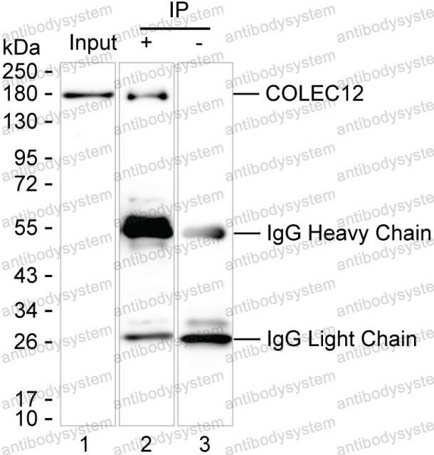 Anti-COLEC12 Antibody (R4C88)