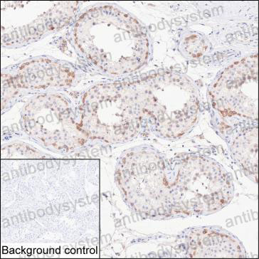 Anti-CUL9 Antibody (R4C90)