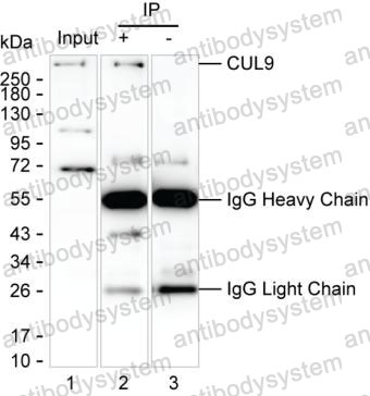 Anti-CUL9 Antibody (R4C91)
