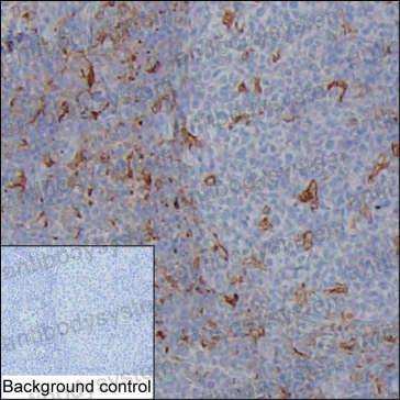 Anti-NAGK Antibody (R4C92)