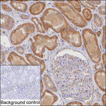 Anti-TACO1 Antibody (R4C93)