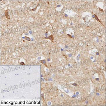 Anti-CAMKK1 Antibody (R4C94)