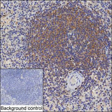 Anti-BLOC1S3 Antibody (R4C95)