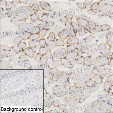 Anti-TRIM72 Antibody (R4C96)