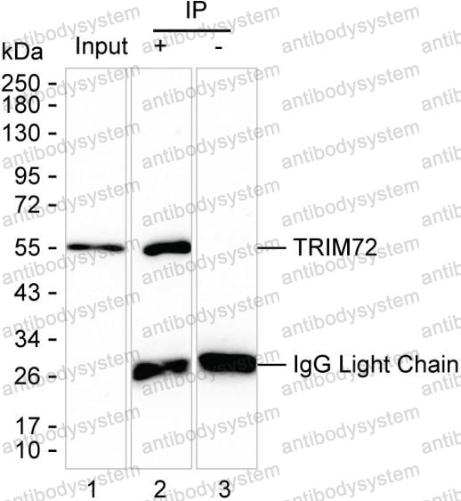 Anti-TRIM72 Antibody (R4C97)