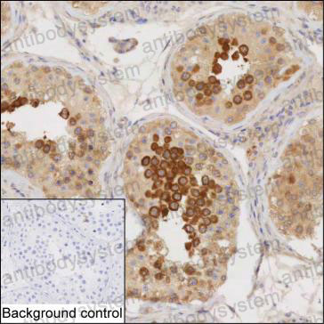 Anti-LZTFL1 Antibody (R4D01)