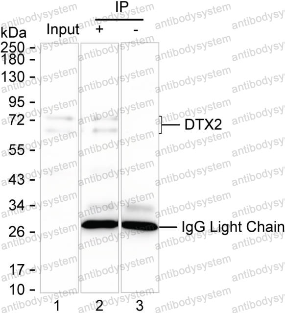 Anti-DTX2 Antibody (R4D04)