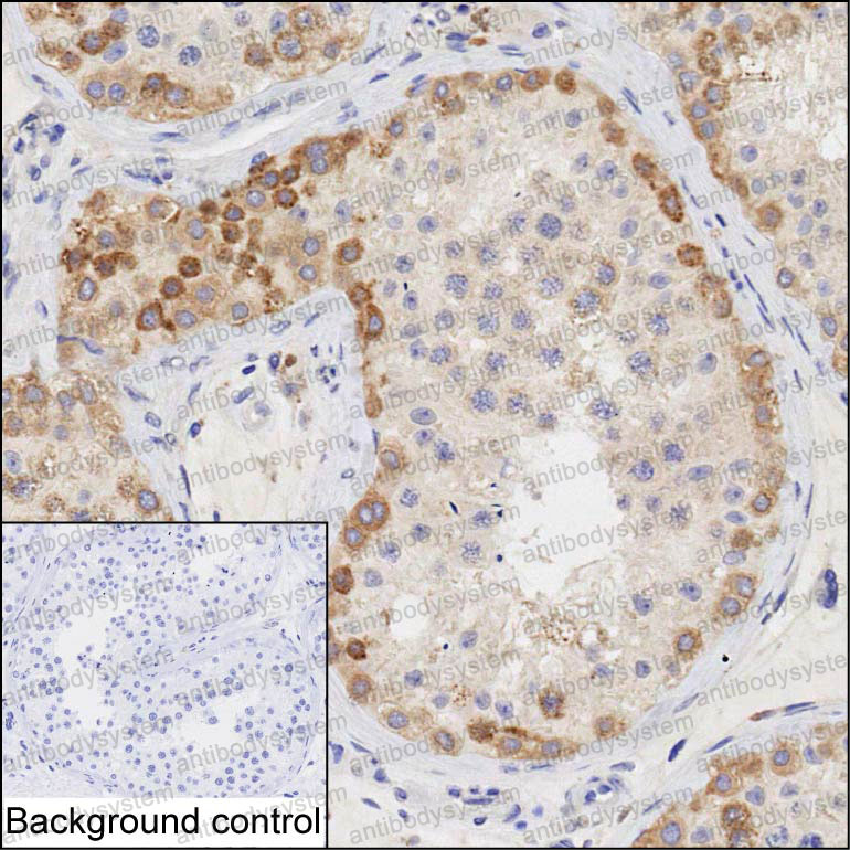 Anti-HERC5 Antibody (R4D07)
