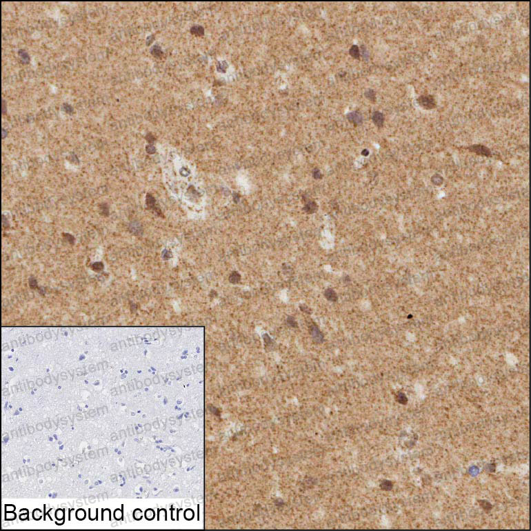 Anti-PJA1 Antibody (R4D08)