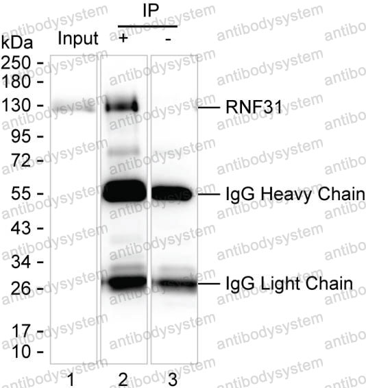 Anti-RNF31 Antibody (R4D10)
