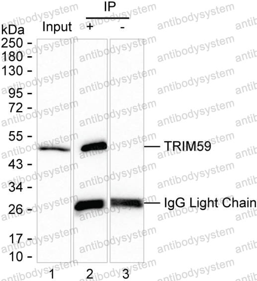 Anti-TRIM59 Antibody (R4D11)