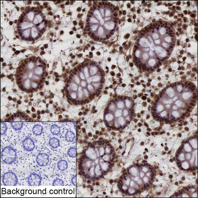 Anti-TRIM35 Antibody (R4D13)