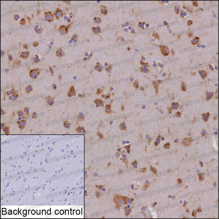 Anti-CDC42BPB Antibody (R4D15)