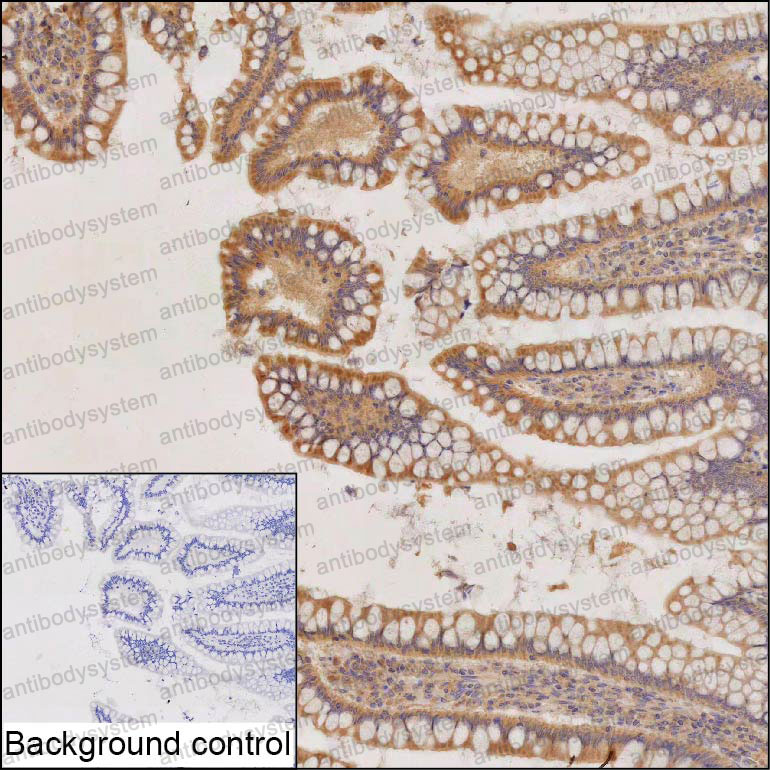 Anti-TRIM40 Antibody (R4D20)