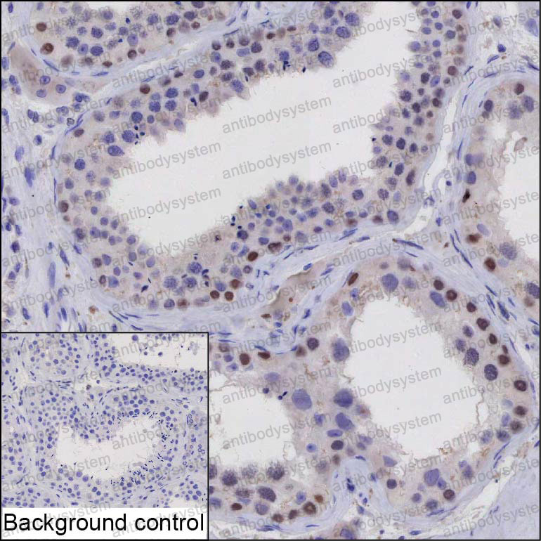 Anti-DPPA4 Antibody (R4D21)