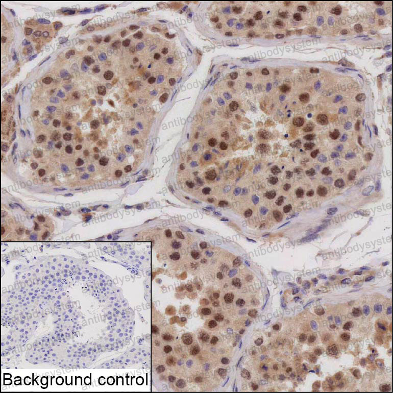 Anti-BABAM1 Antibody (R4D22)