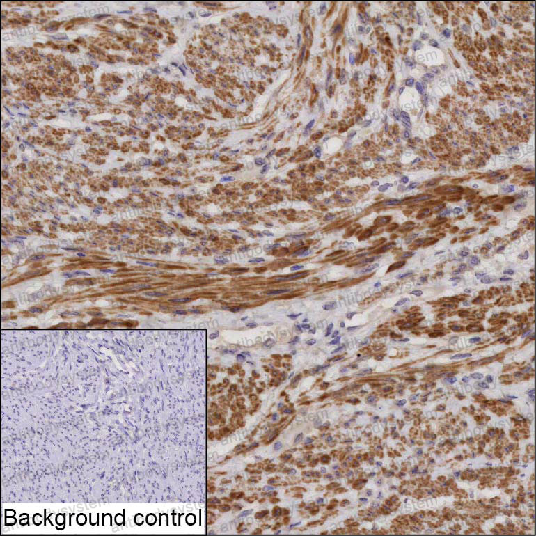 Anti-PDZRN4 Antibody (R4D23)