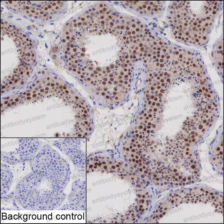 Anti-VRK1 Antibody (R4D25)
