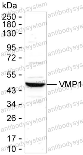 Anti-VMP1 Antibody (R4D27)