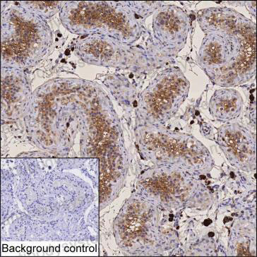 Anti-VMP1 Antibody (R4D28)
