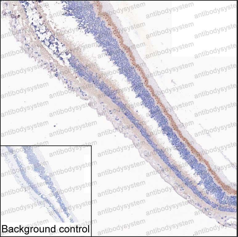 Anti-PCARE Antibody (R4D40)