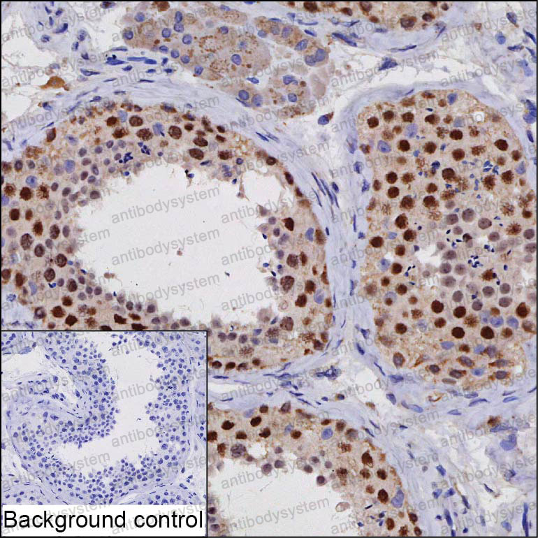 Anti-PSMC3IP Antibody (R4D42)
