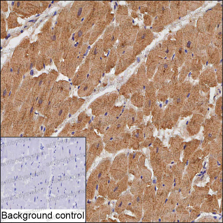 Anti-TBC1D17 Antibody (R4D43)