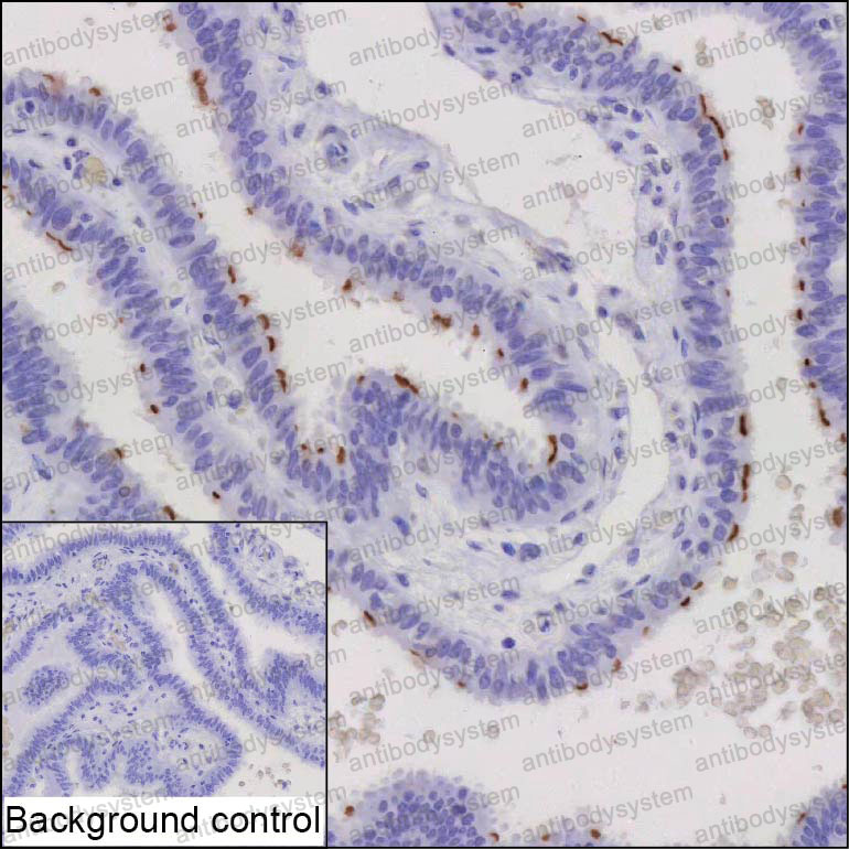 Anti-CAPSL Antibody (R4D50)
