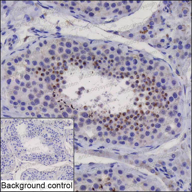 Anti-ANKRD26P1 Antibody (R4D52)